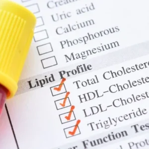 Lipid Profile