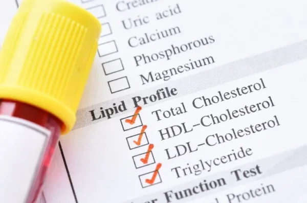 Lipid Profile